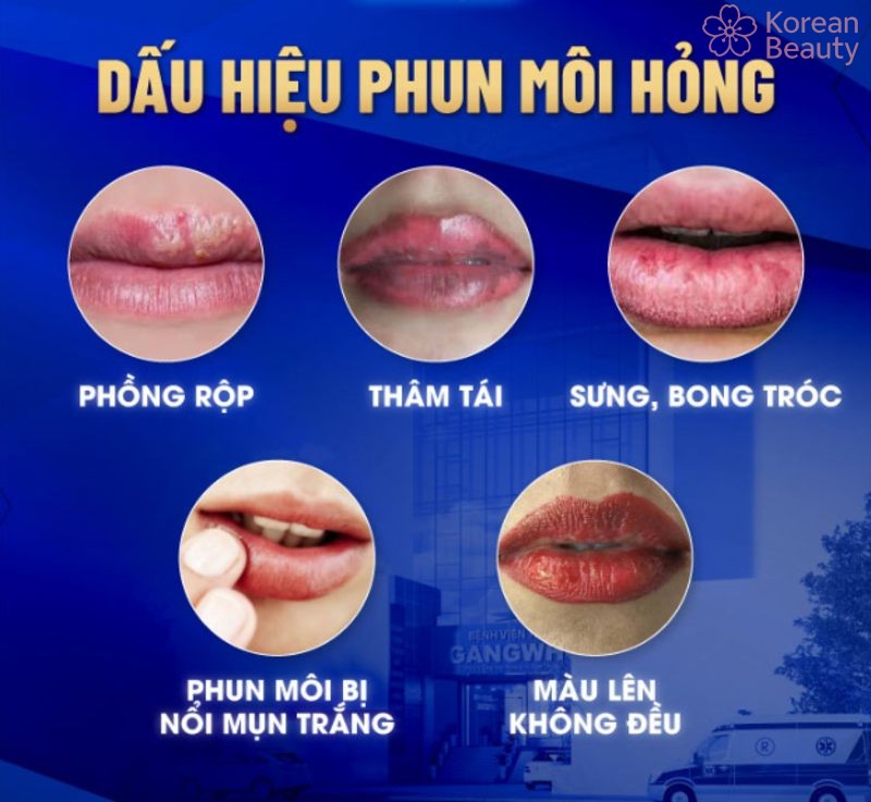 Những vấn đề thường hay gặp phải khi thực hiện phun môi