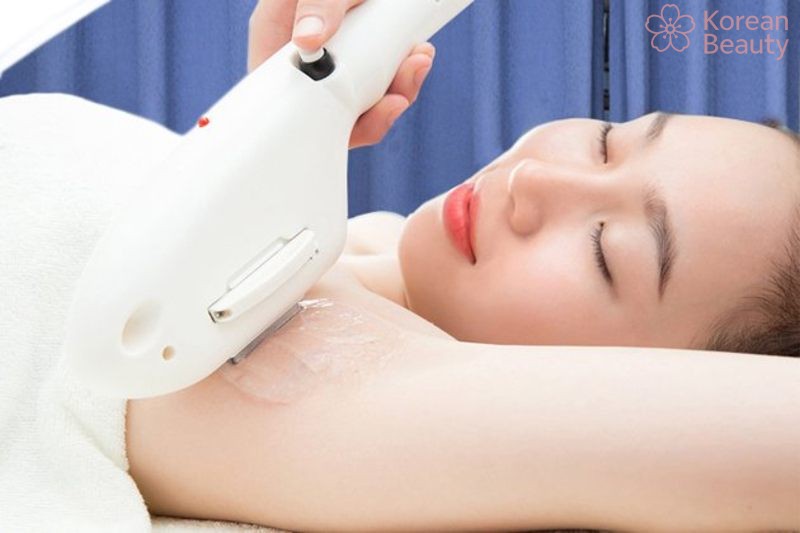Thông tin tổng quan về cách triệt lông nách tại spa