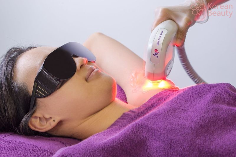 Cơ chế hoạt động và nguyên lý vận hành của công nghệ triệt lông AFT