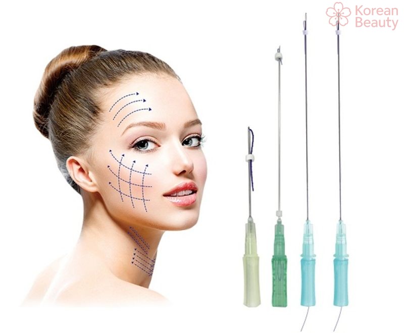 Các loại chỉ dùng để nâng mũi phổ biến nhất hiện nay