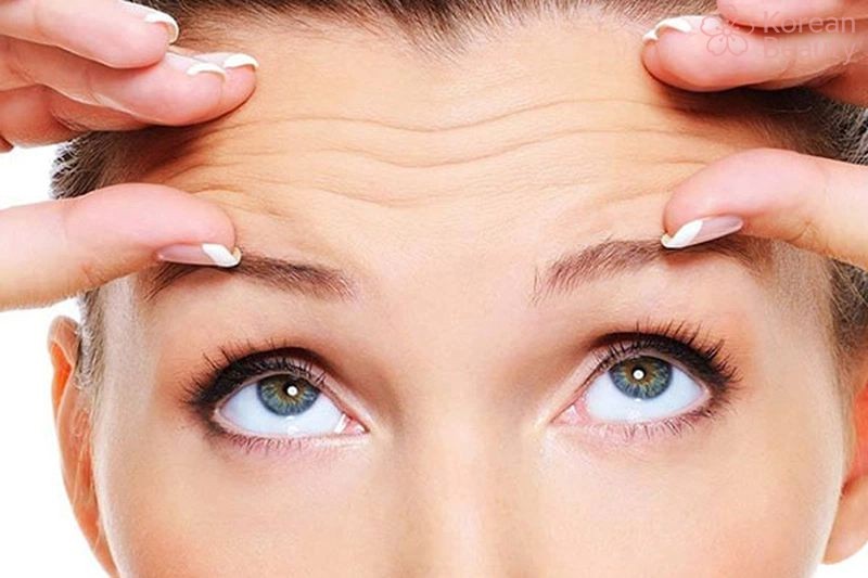 Những đối tượng phù hợp nhất để thực hiện liệu pháp nâng cung mày