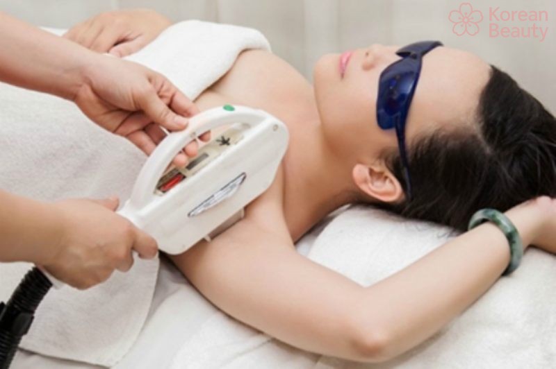 Những đặc điểm nổi bật của công nghệ triệt lông công nghệ nano light