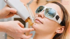 Quá trình chăm sóc sau khi thực hiện tẩy nốt ruồi và những khoản chi phí phát sinh