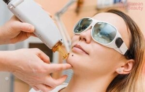 Quá trình chăm sóc sau khi thực hiện tẩy nốt ruồi và những khoản chi phí phát sinh