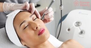 Quy trình thực hiện xóa nốt ruồi bằng laser và thời gian hồi phục