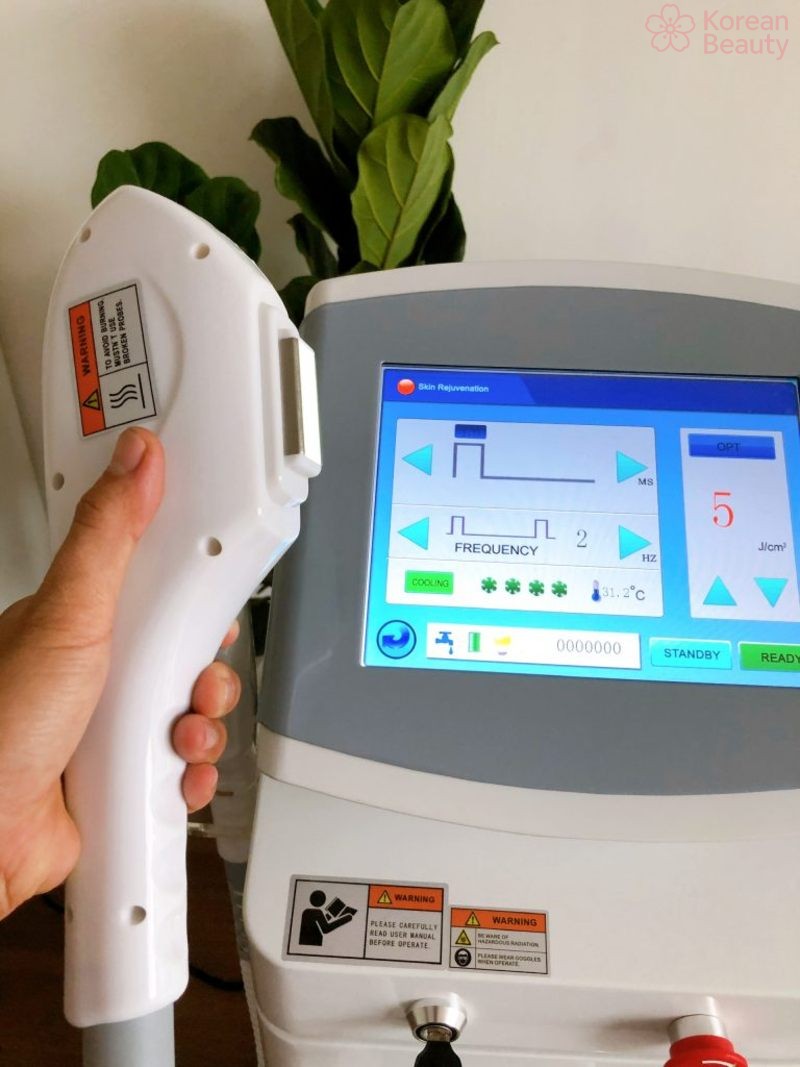 Những chuẩn bị cần thiết trước khi sử dụng máy triệt lông IPL