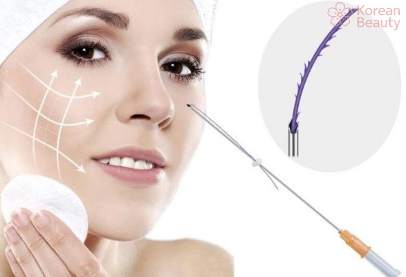 Những đặc điểm của phương pháp nâng mũi bằng chỉ