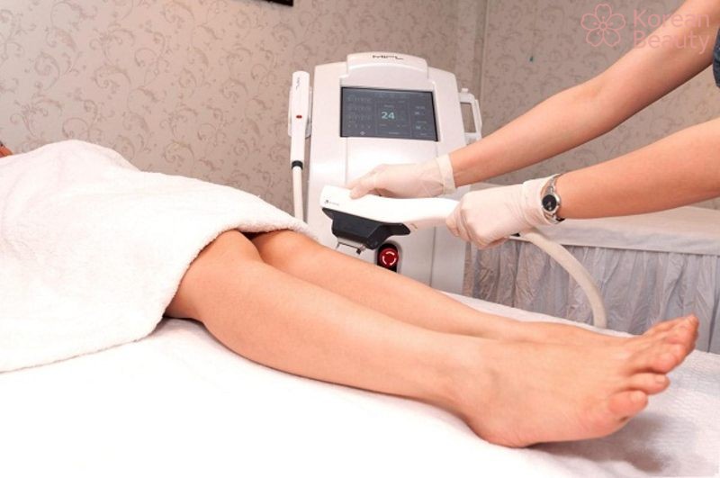 Những lưu ý quan trọng khi sử dụng công nghệ triệt lông IPL