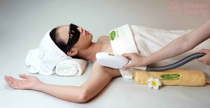 Giá chi phí và mức độ hiệu quả của các phương pháp triệt lông nách phổ biến tại spa