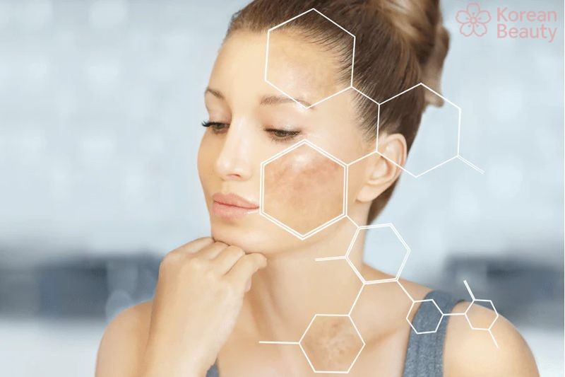 Những phương pháp điều trị tình trạng da bị tăng sắc tố hiệu quả