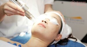 Quy trình thực hiện chăm sóc da sau khi tiến hành tẩy nốt ruồi công nghệ cao