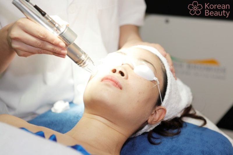 Quy trình thực hiện chăm sóc da sau khi tiến hành tẩy nốt ruồi công nghệ cao