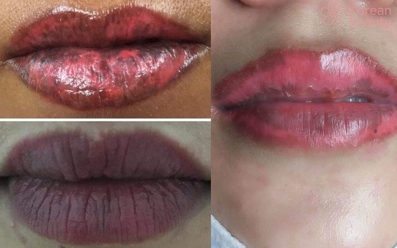 Những phương pháp khắc phục tình trạng phun môi bị hỏng hiệu quả