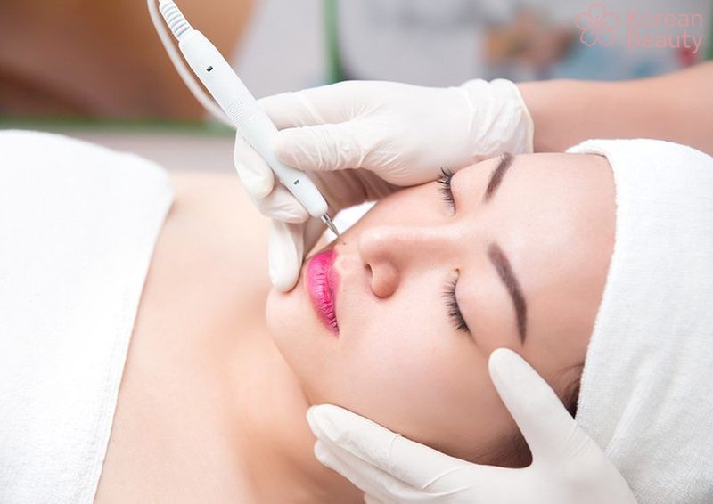 Những phương pháp giúp tiết kiệm chi phí khi thực hiện xóa nốt ruồi bằng laser