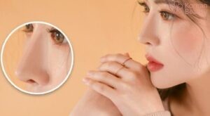 Những biến chứng xấu gây ảnh hưởng đến thời gian duy trì nâng mũi bằng chỉ