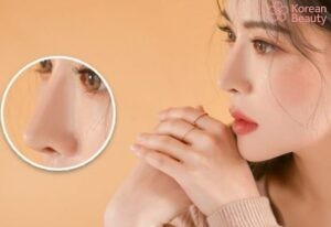 Những biến chứng xấu gây ảnh hưởng đến thời gian duy trì nâng mũi bằng chỉ