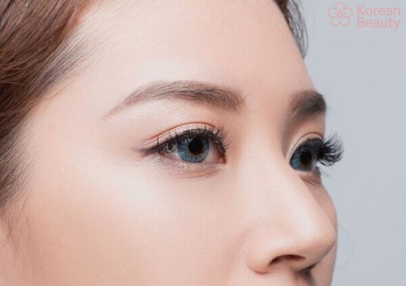 Kết quả và thời gian hồi phục sau khi thực hiện nâng cung mày