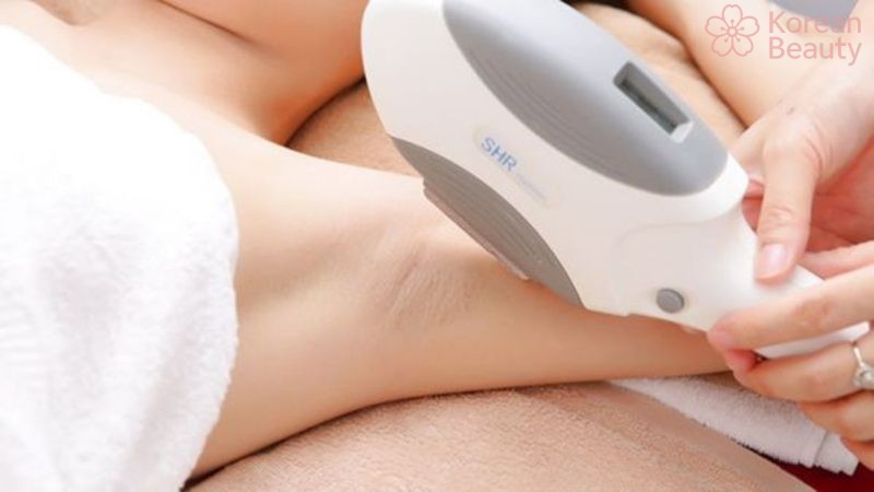 Xu hướng phát triển của công nghệ triệt lông IPL hiện nay