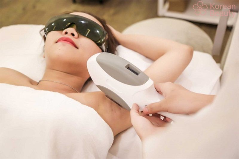 Những lưu ý quan trọng khi sử dụng máy triệt lông IPL