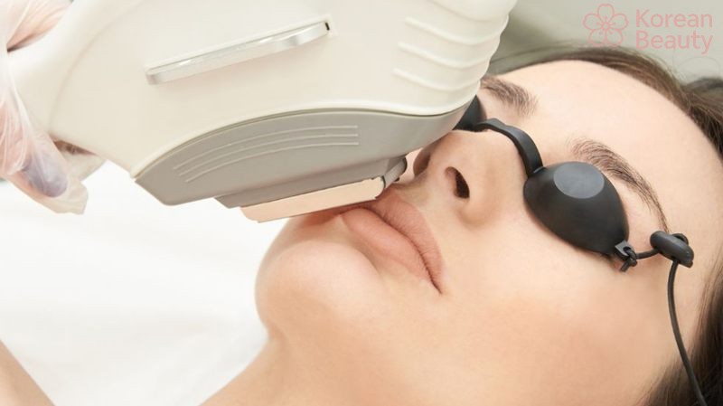 Chi phí sử dụng và các dói dịch cụ công nghệ triệt lông AFT phù hợp nhất