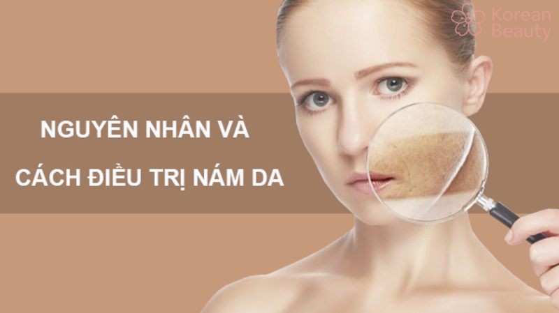 Những vấn đề phổ biến trong việc điều trị da bị nám nhẹ