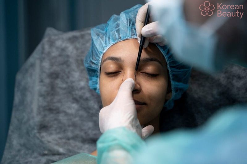 Quy trình thực hiện nâng mũi chuẩn tại các cơ sở uy tín tại Sài Gòn