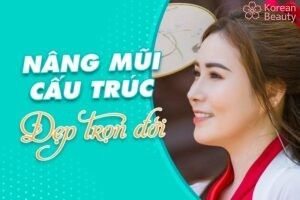 Thời gian duy trì của phương pháp nâng mũi bán cấu trúc là nao nhiêu?