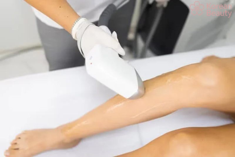 Hiệu quả tối ưu mà cách sử dụng máy triệt lông IPL mang đến