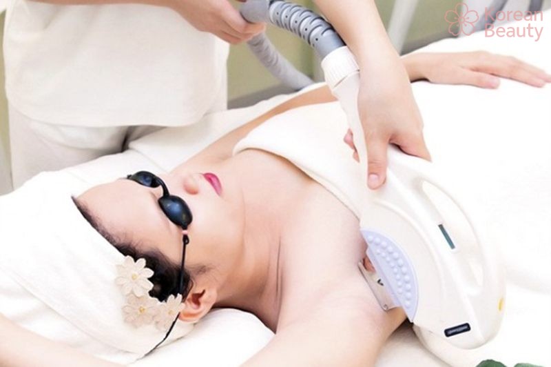 Những vấn đề liên quan đến công nghệ triệt lông công nghệ nano light