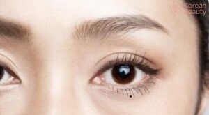 Những vấn đề liên quan đến nốt ruồi dưới bọng mắt trái nữ