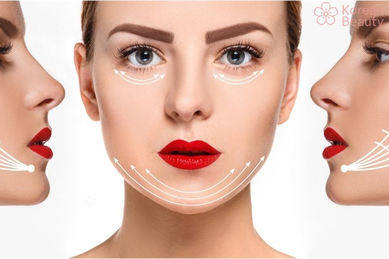 Những vấn đề hay gặp về phương pháp nâng cơ trẻ hóa